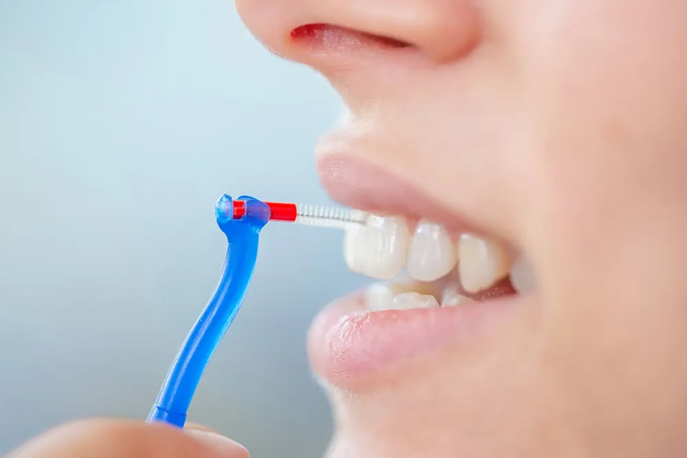 Den korrekte måde at bruge en interdentalbørste på